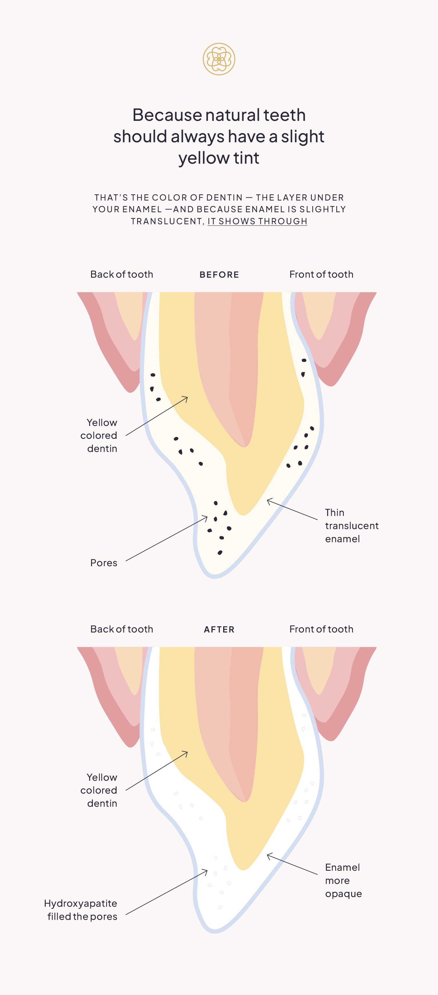Diagram showing the difference between natural teeth and whitened teeth, with text explaining the process.